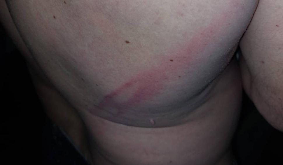 Un primar le-a spart nasul mai multor politicieni, după un meci de fotbal, în Timiș 802736