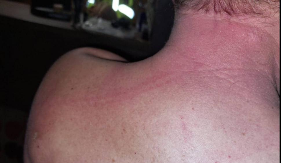 Un primar le-a spart nasul mai multor politicieni, după un meci de fotbal, în Timiș 802737