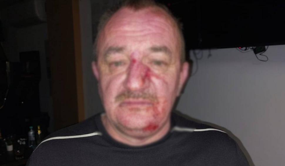 Un primar le-a spart nasul mai multor politicieni, după un meci de fotbal, în Timiș 802739