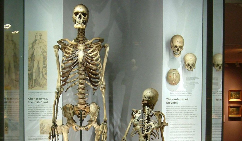 "Uriașul irlandez" se temea să nu ajungă exponat după moarte. 200 de ani, oamenii au plătit ca să îi vadă corpul la muzeu