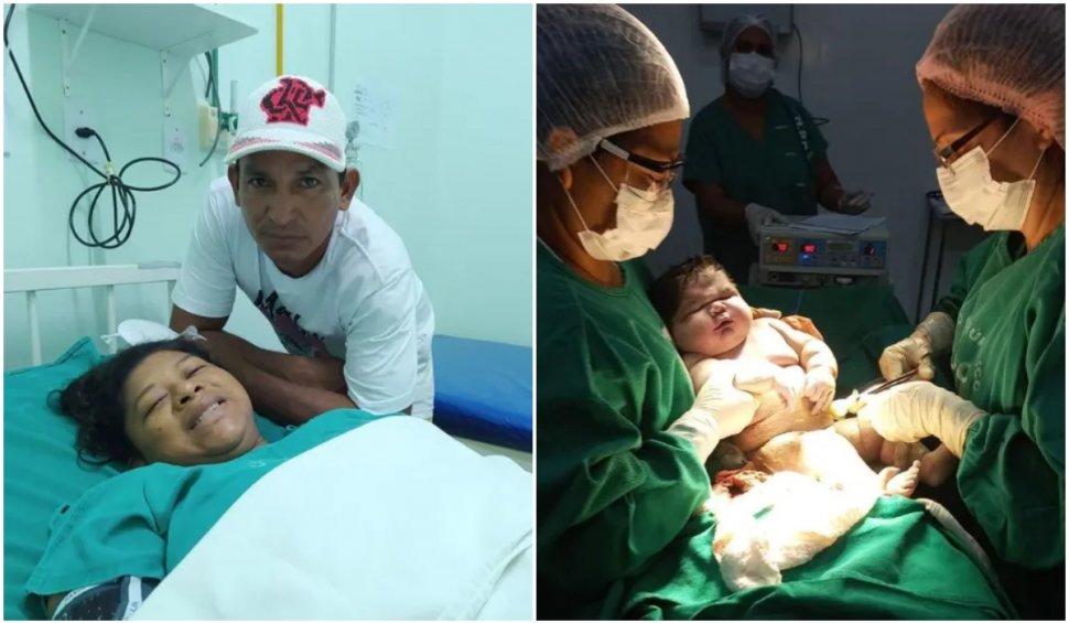 O femeie din Brazilia a dat naștere unui bebeluș gigant: 7,3 kilograme