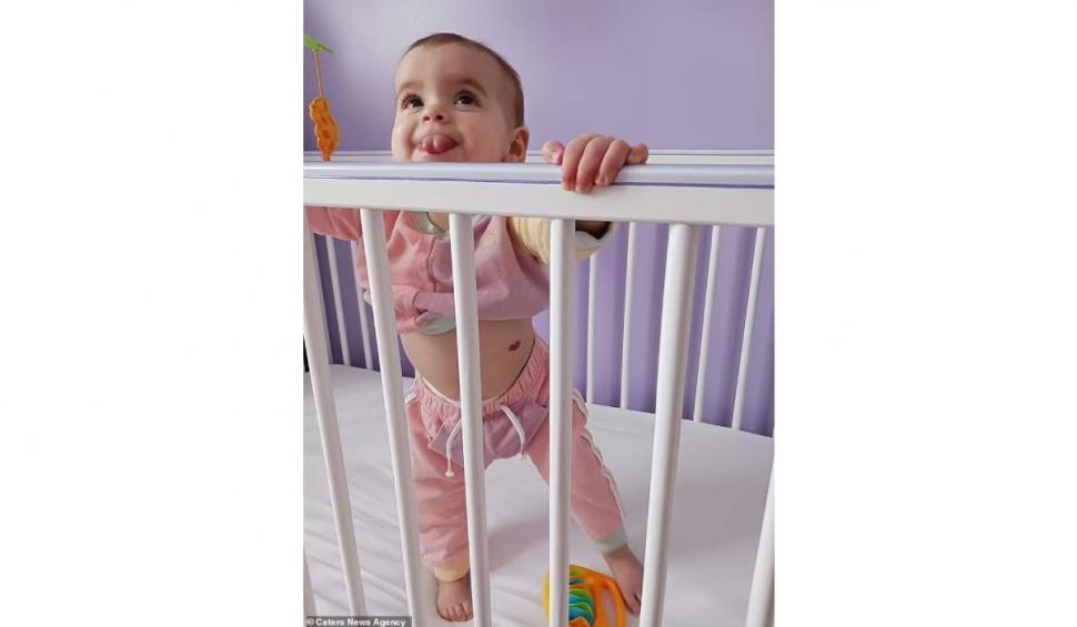 Semnul cu care o fetiță s-a născut pe corp, în luna iubirii. Medicii au rămas uluiți: "Au crezut că se va estompa, dar nu a dispărut"  816718