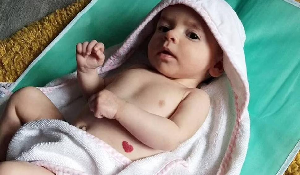 Semnul cu care o fetiță s-a născut pe corp, în luna iubirii. Medicii au rămas uluiți: "Au crezut că se va estompa, dar nu a dispărut"  816722