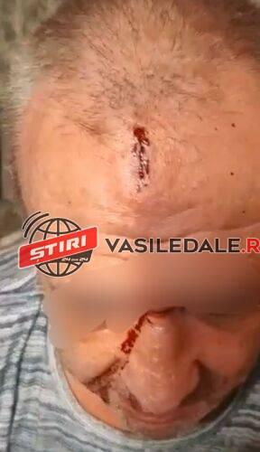 Bărbat cu dizabilități și copiii săi, atacați în propriul apartament din Baia Mare cu lopata 819665