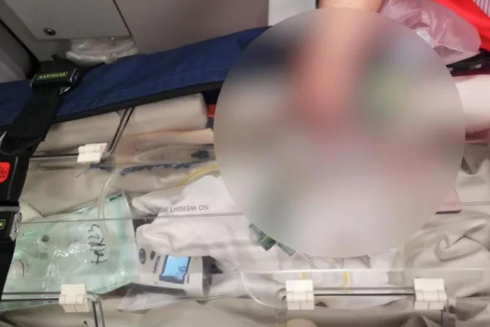 Bebeluş microsom, născut de o româncă de 19 ani la maternitatea din Botoşani 825731