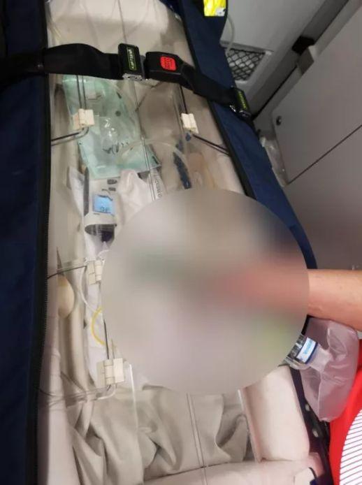 Bebeluş microsom, născut de o româncă de 19 ani la maternitatea din Botoşani 825732