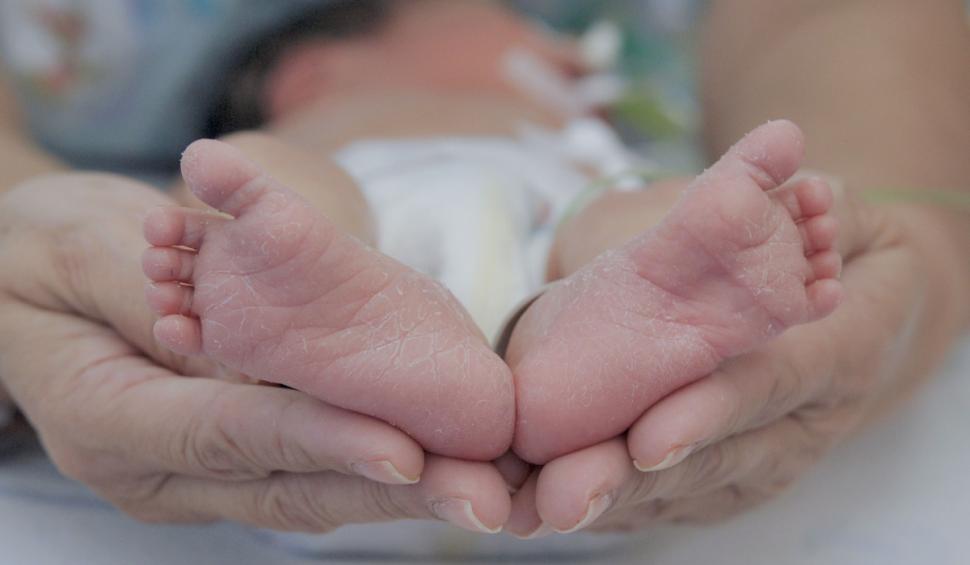 Bebeluş microsom, născut de o româncă de 19 ani la maternitatea din Botoşani 826046