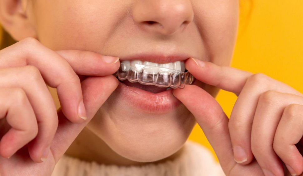 ”Scrâșnitul” dinților: tot ce trebuie să știm | Cauze, simptome, tratament