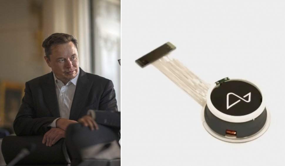 Compania lui Elon Musk a primit aprobare să implanteze cipuri conectate la internet în creierul oamenilor