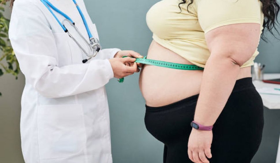 Obezitatea pune stăpânire pe populația adultă din România. 2 din 4 persoane sunt supraponderale