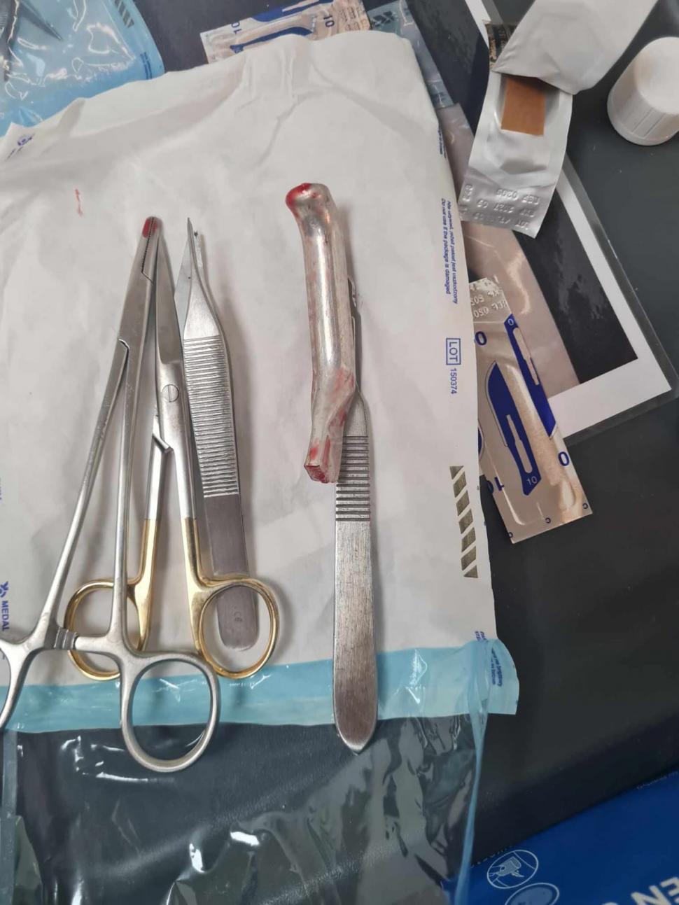 Un medic de la spitalul din Urlați a cusut în piciorul unui tânăr mânerul de frână de la bicicletă și l-a trimis acasă 850115