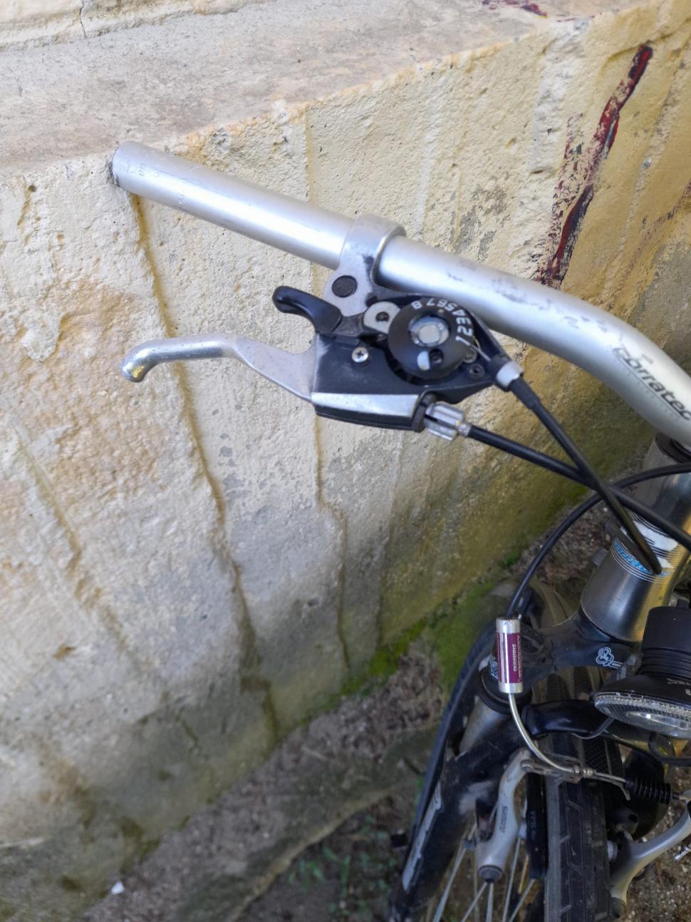 Un medic de la spitalul din Urlați a cusut în piciorul unui tânăr mânerul de frână de la bicicletă și l-a trimis acasă 850121