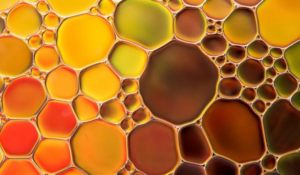 Alimente care îngraşă cel mai tare. Medic: "Se multiplică de trei ori mai mult celulele grase, au efecte diferite" 850315