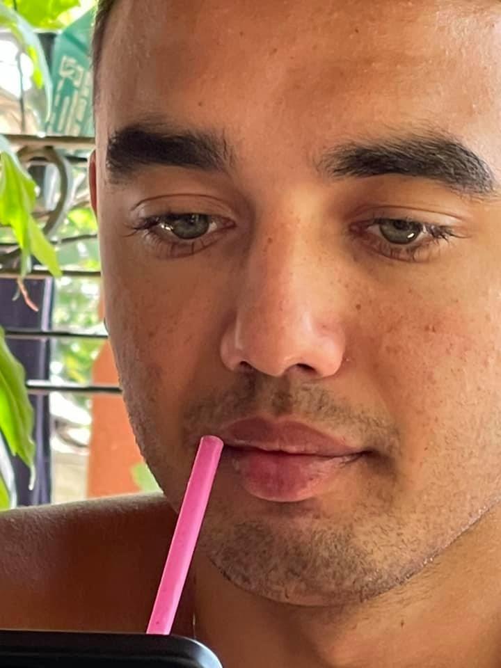 El este Eric, tânărul de 19 ani grav rănit după ce a fost spulberat de un skijet la Eforie. Mama sa îi caută pe vinovaţi: "E straniu" 852140