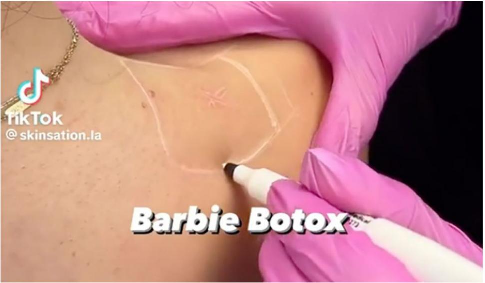 "Barbie Botox", cea mai virală procedură estetică în rândul tinerelor pe Tik Tok. Tot mai multe visează la un corp de păpuşă 853528