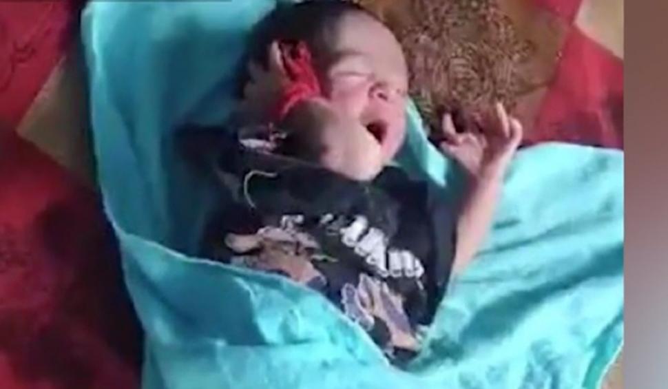 Caz extrem de rar în India. O fetiţă s-a născut cu 26 de degete | Familia crede că este reîncarnarea unei zeiţe  859397