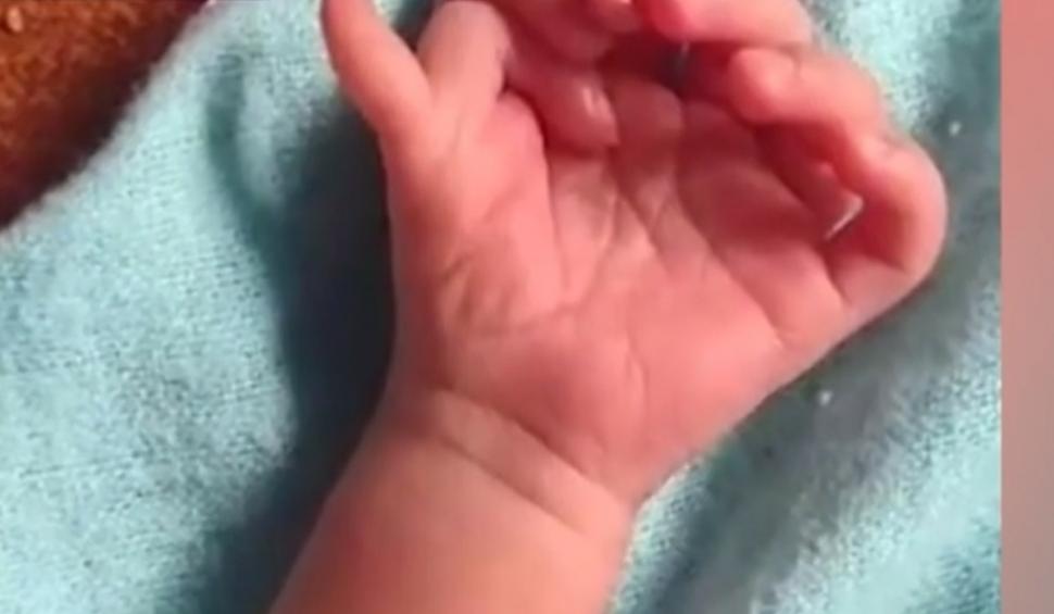 Caz extrem de rar în India. O fetiţă s-a născut cu 26 de degete | Familia crede că este reîncarnarea unei zeiţe  859398