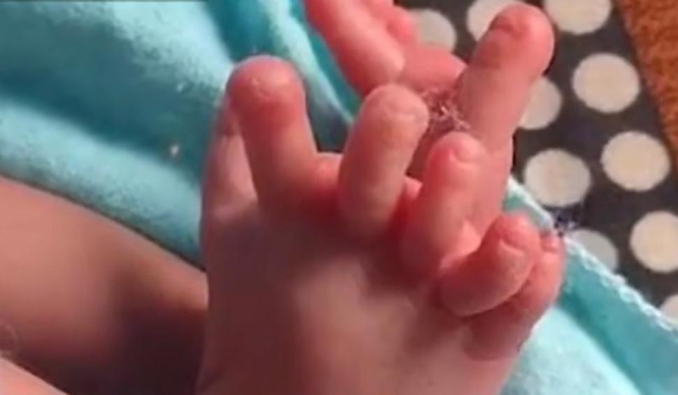 Caz extrem de rar în India. O fetiţă s-a născut cu 26 de degete | Familia crede că este reîncarnarea unei zeiţe  859399