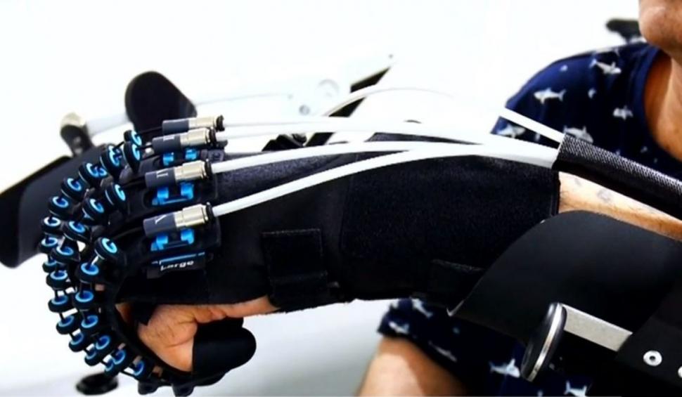 Mănușa robotică ce ajută pacienții care au suferit un AVC să aibă o viață normală, într-un spital din Bacău: ”Pare desprinsă din filmele SF” 860816