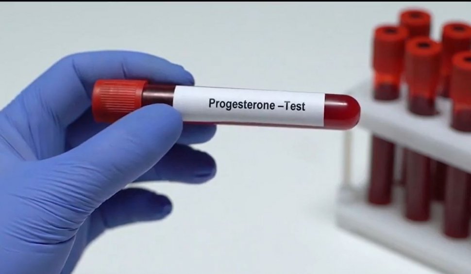 Deficitul de progesteron, unul dintre cele mai comune dezechilibre hormonale