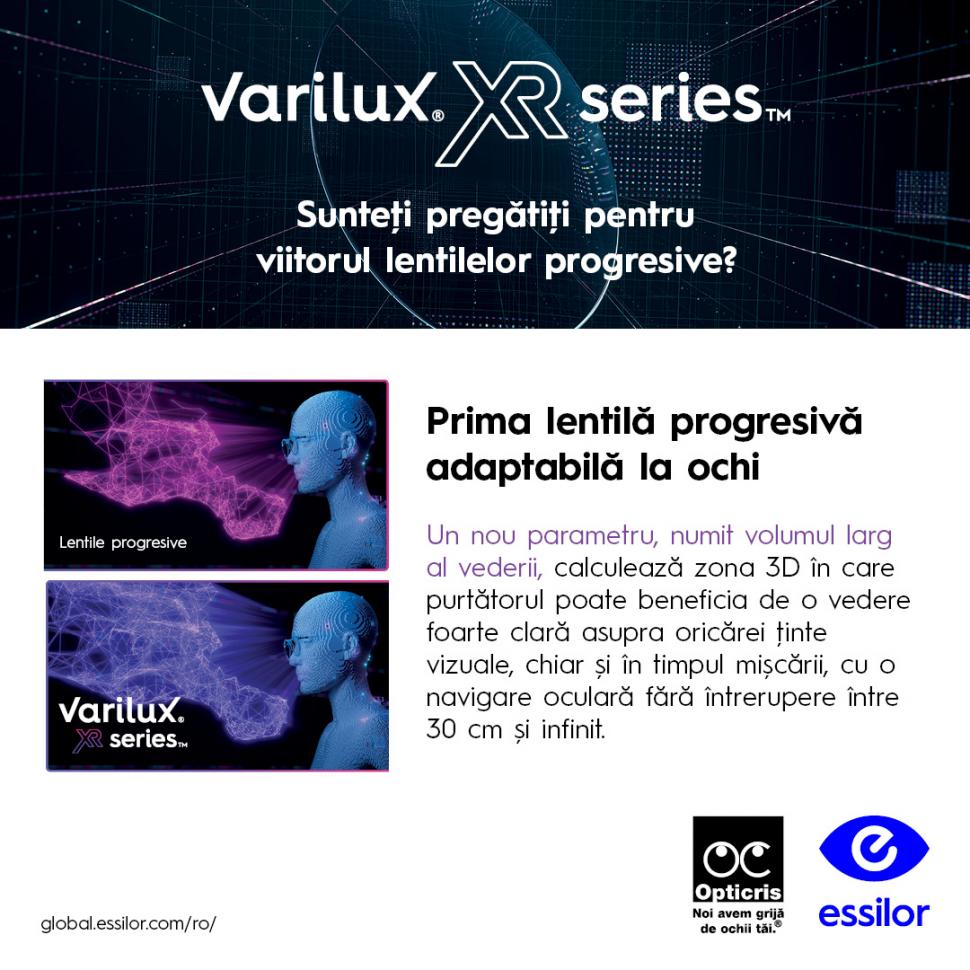 Inovații uimitoare pentru sănătatea ochilor de Ziua Mondială a Vederii 863340