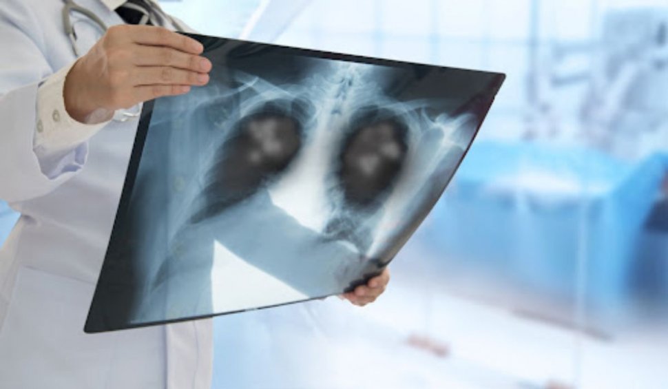 ”Focare de pneumonie nediagnosticată”, descoperite la copiii din China. OMS cere mai multe informații