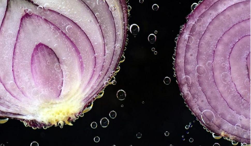 Adevărul despre slănina cu ceapa, mâncată de români. Dr. Vlad Ciurea: "Să știm ce ne face rău. E foarte greu să schimbi alimentația" 873428