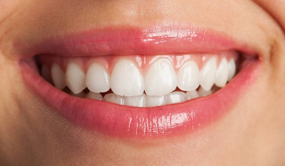 Mituri despre albirea dinţilor care pot afecta dantura