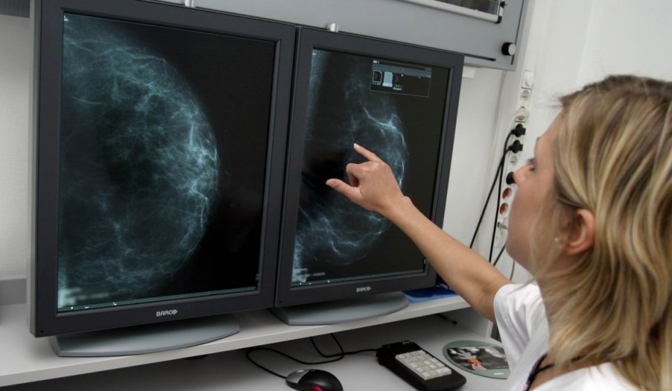 Tratamente noi în România, pentru femeile cu cancer la sân. Medic Oncolog: "Sunt medicamente nou apărute, avem acces la ele"