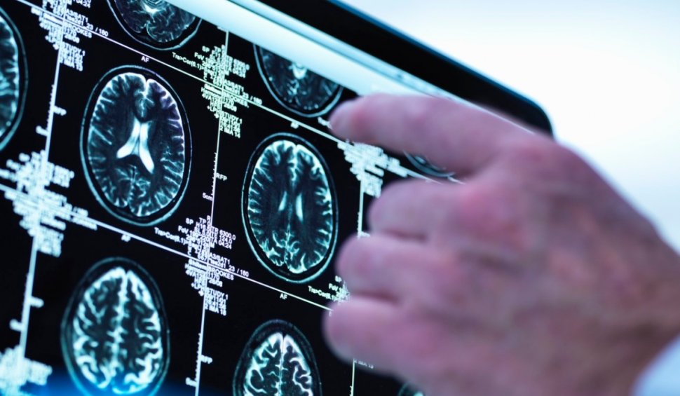 Medic neurochirurg, despre diferenţa dintre CT şi RMN | Informaţii ultile pentru rezultate cât mai precise