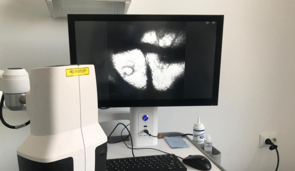 Spitalul din România care are echipamente unice pentru depistarea cancerului de piele prin metode non-invazive 887339