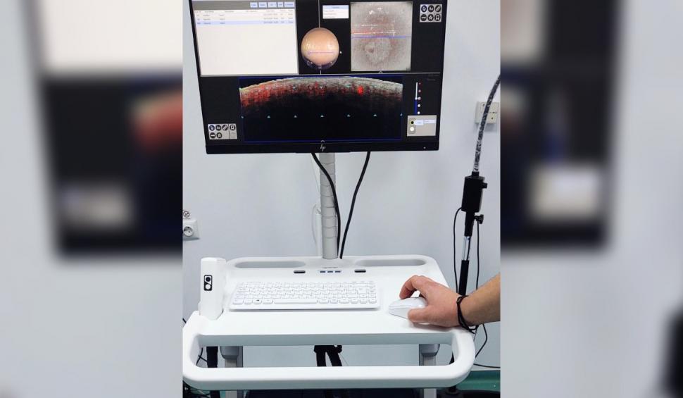 Spitalul din România care are echipamente unice pentru depistarea cancerului de piele prin metode non-invazive 887342