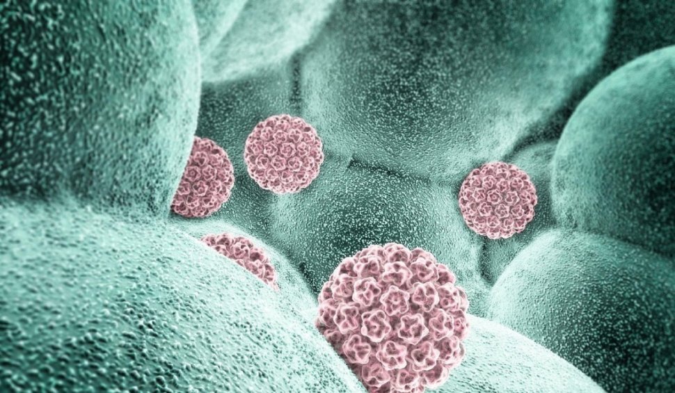Datele INSP care arată legătura dintre cazurile de cancer diagnosticate în România și infecţia cu virusul HPV
