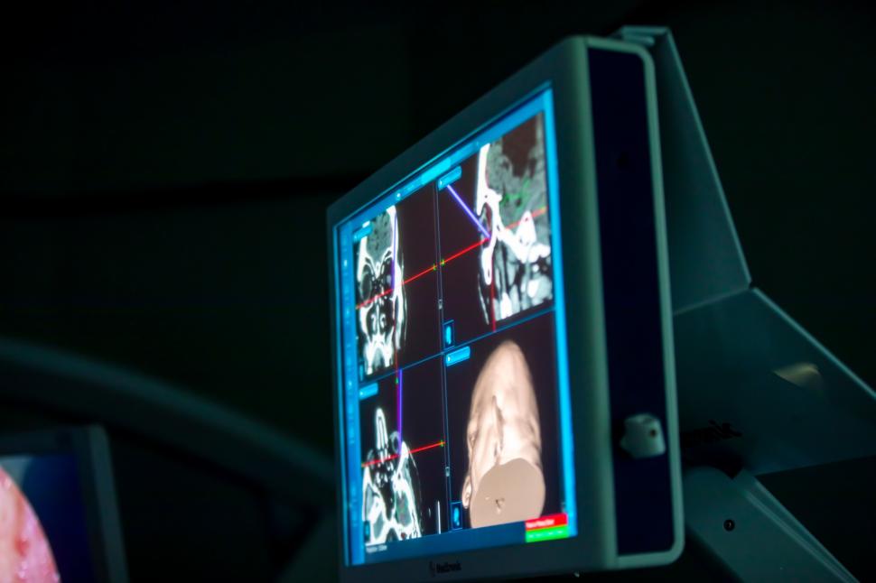 Prima operație pe creier prin pleoapă a avut loc la Spitalul Militar Central din Capitală 890932