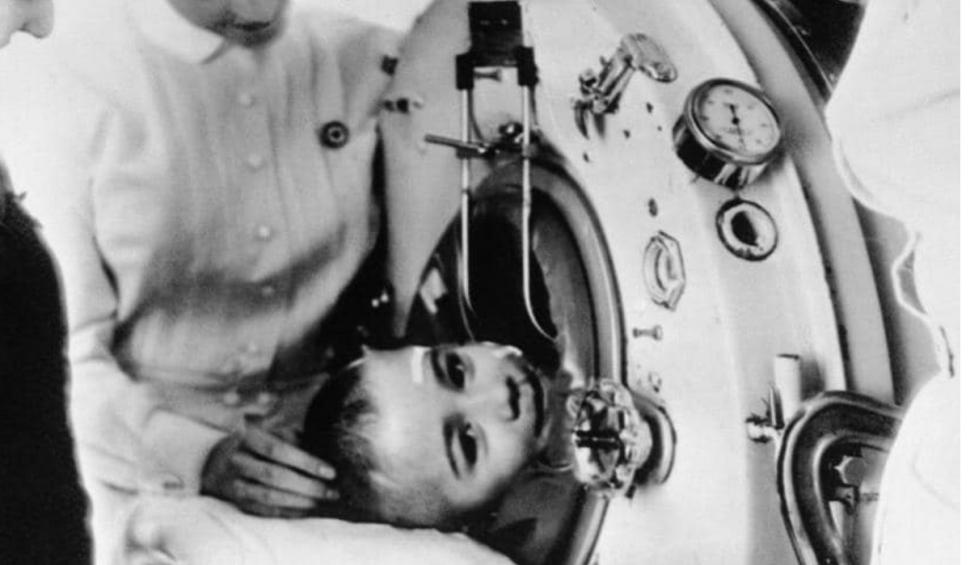 A murit Paul Alexander, bărbatul care și-a trăit aproape toată viața într-un plămân de oțel 891678