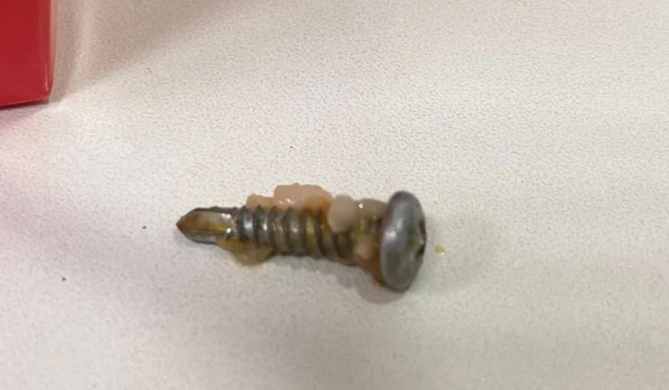 "Bine că l-am depistat înainte să ajungă în stomac" | Păţania unei femei care a găsit "surprize" în mancarea comandată de la un fast-food din Cluj 892938