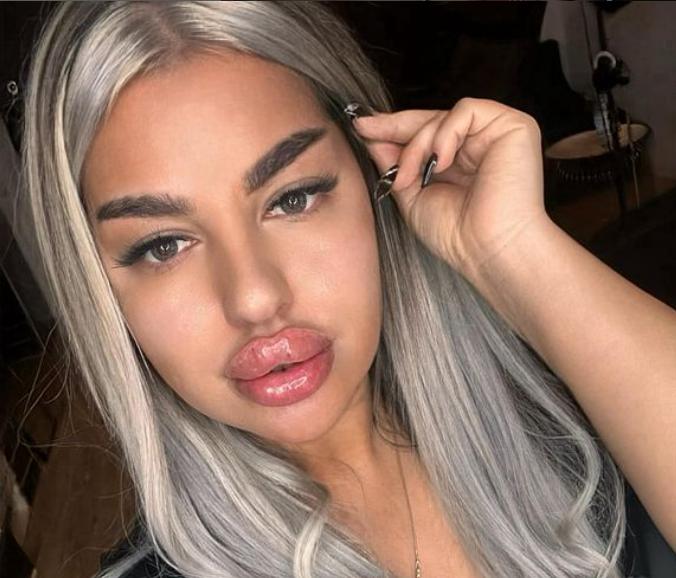 Ea este Nicoleta, tânăra care se dădea medic şi făcea intervenții de chirurgie plastică. Poliţiştii i-au făcut o vizită azi!   894149