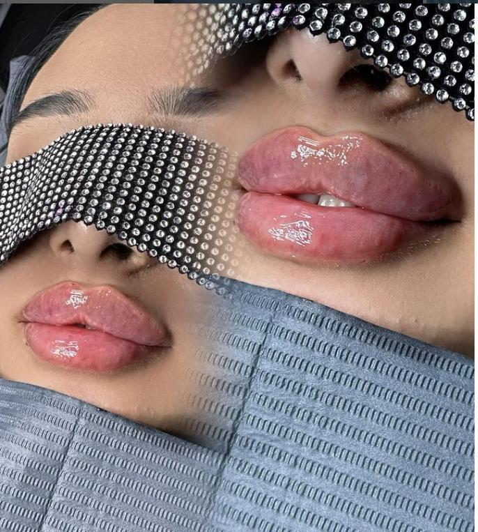 Femeia care a făcut operații de chirurgie plastică, fără să fie medic, a fost reținută 894177