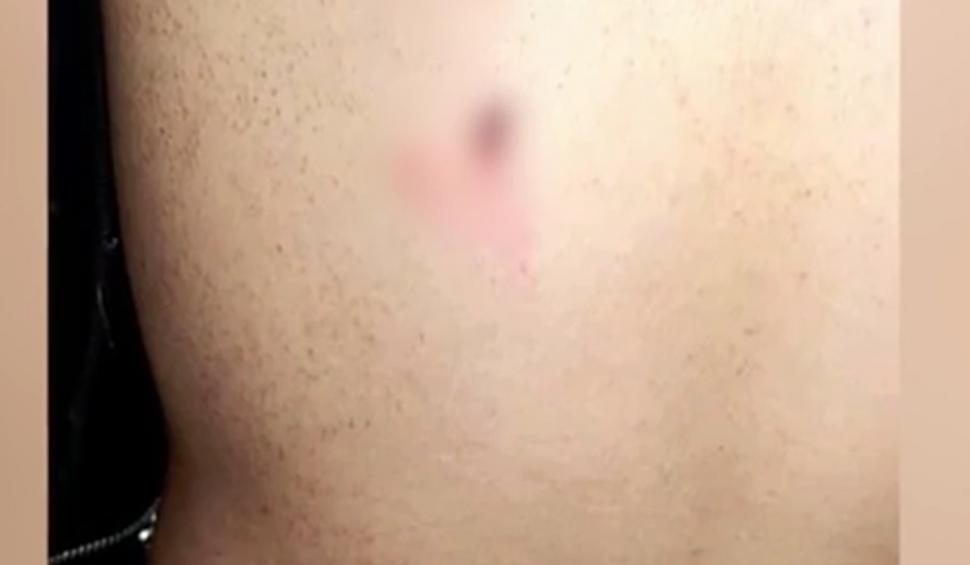 "Este şocat, nu mai doarme de durere" | Un adolescent a fost snopit în bătaie cu bolobocul de un bărbat, în faţa unui liceu din Constanţa 896183