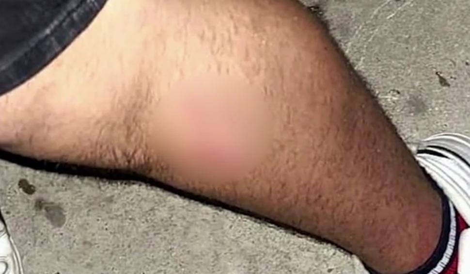 "Este şocat, nu mai doarme de durere" | Un adolescent a fost snopit în bătaie cu bolobocul de un bărbat, în faţa unui liceu din Constanţa 896185