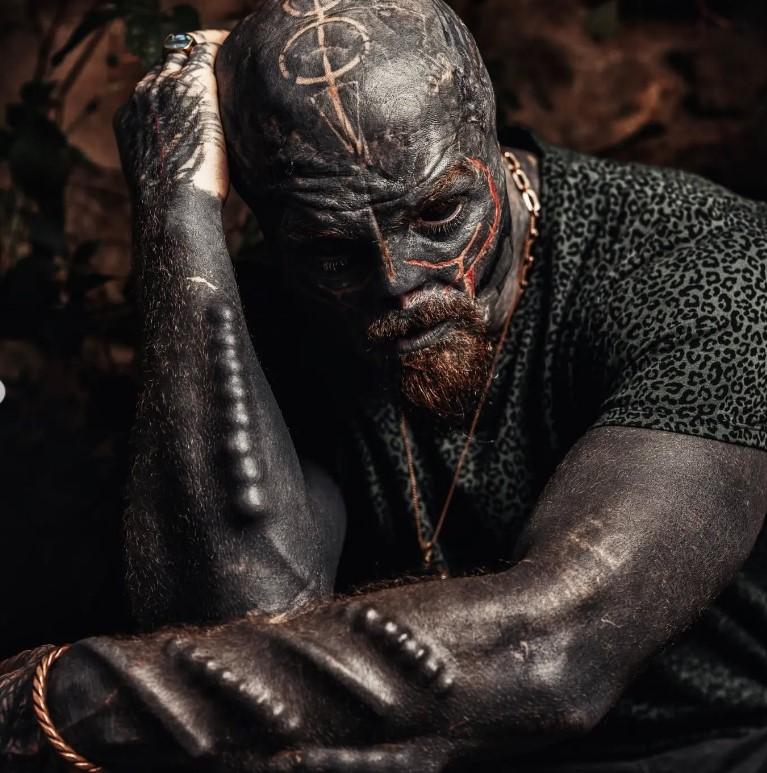 Povestea incredibilă a „celui mai modificat om din lume”. S-a mutat în altă țară ca să-și poată taia urechile și nasul 935813