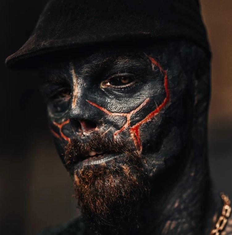 Povestea incredibilă a „celui mai modificat om din lume”. S-a mutat în altă țară ca să-și poată taia urechile și nasul 935814