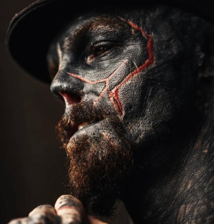 Povestea incredibilă a „celui mai modificat om din lume”. S-a mutat în altă țară ca să-și poată taia urechile și nasul 935815