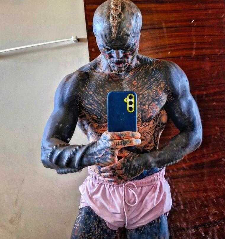 Povestea incredibilă a „celui mai modificat om din lume”. S-a mutat în altă țară ca să-și poată taia urechile și nasul 935819