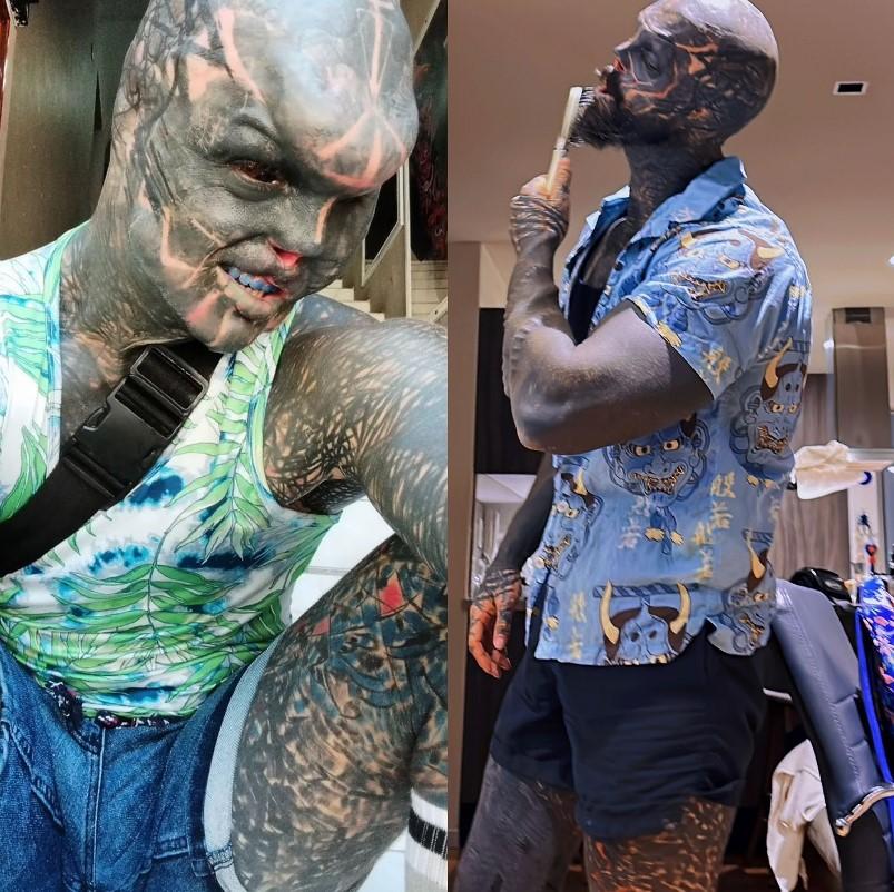 Povestea incredibilă a „celui mai modificat om din lume”. S-a mutat în altă țară ca să-și poată taia urechile și nasul 935822