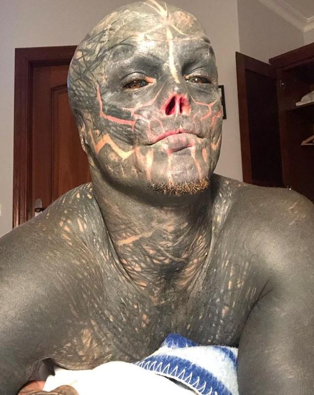 Povestea incredibilă a „celui mai modificat om din lume”. S-a mutat în altă țară ca să-și poată taia urechile și nasul 935824