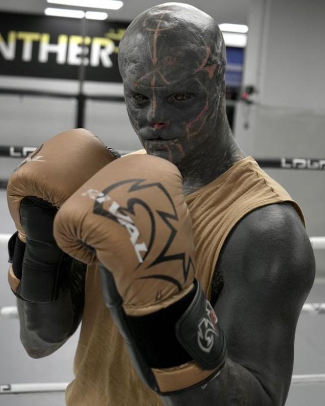 Povestea incredibilă a „celui mai modificat om din lume”. S-a mutat în altă țară ca să-și poată taia urechile și nasul 935825