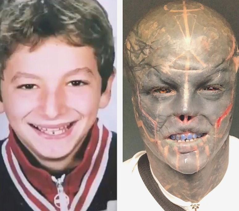 Povestea incredibilă a „celui mai modificat om din lume”. S-a mutat în altă țară ca să-și poată taia urechile și nasul 935826