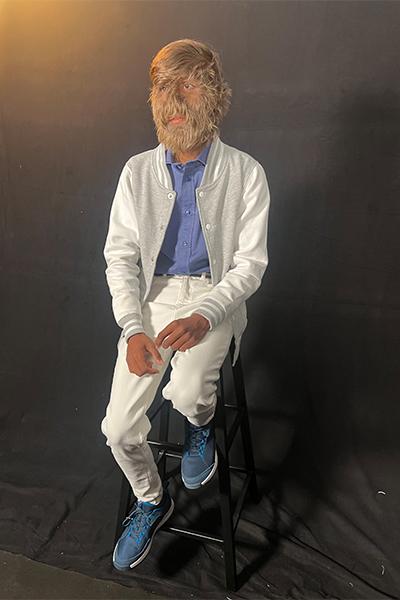 „Le era frică de mine”: Povestea lui Lalit, tânărul care tocmai a intrat în Cartea Recordurilor cu „cea mai păroasă față din lume” 956332