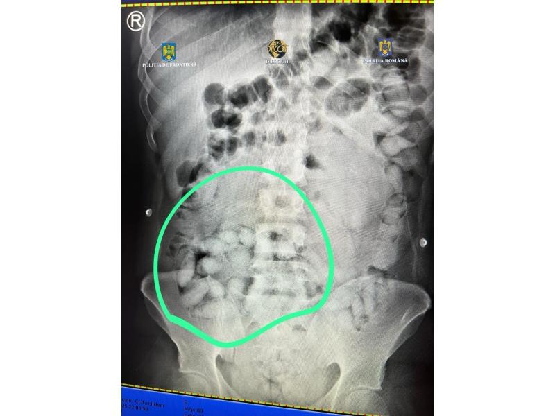 Un brazilian a fost prins pe Aeroportul Otopeni cu pachete cu droguri în stomac 956450